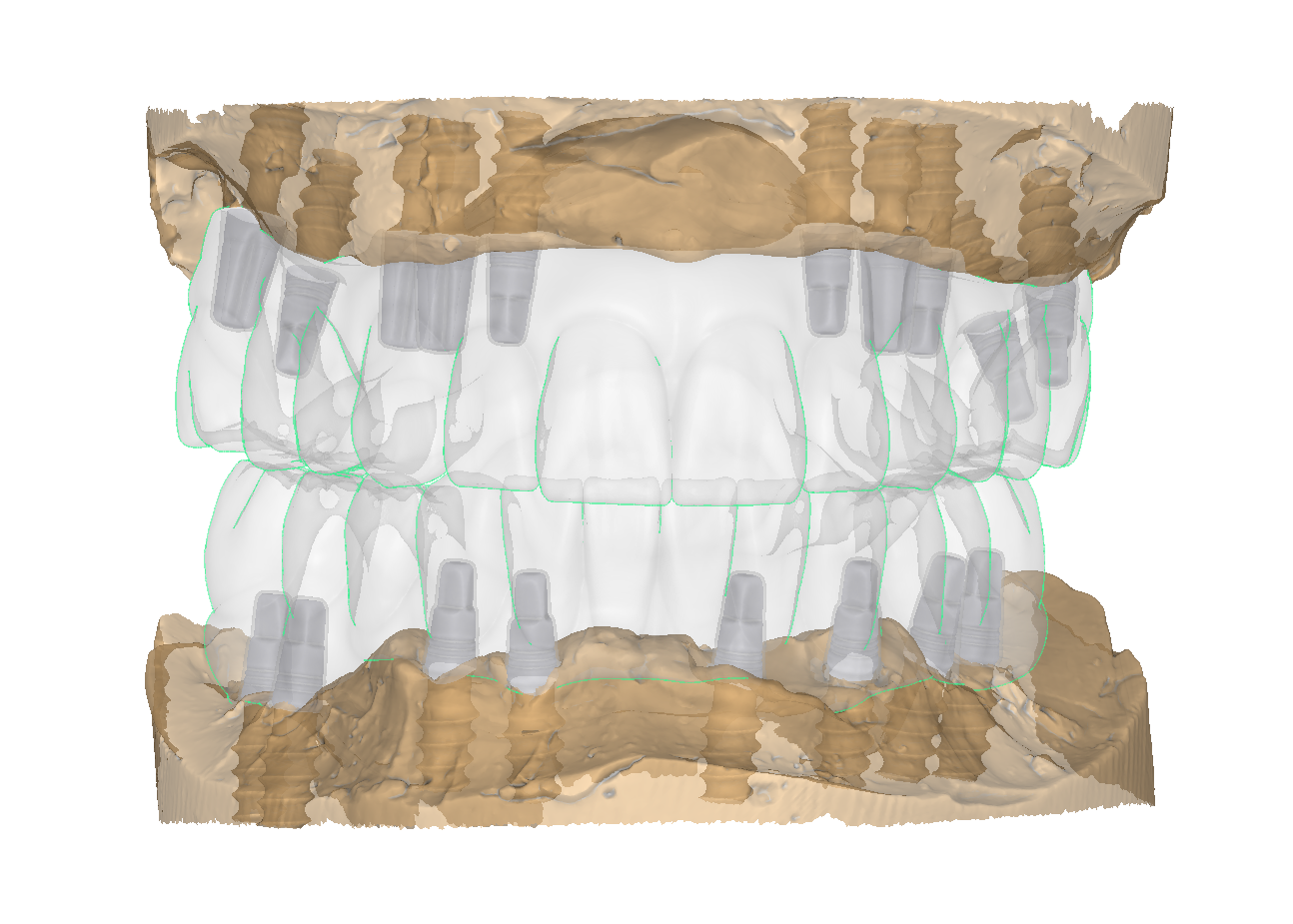 Captura De Pantalla 2025 05 05 225220
