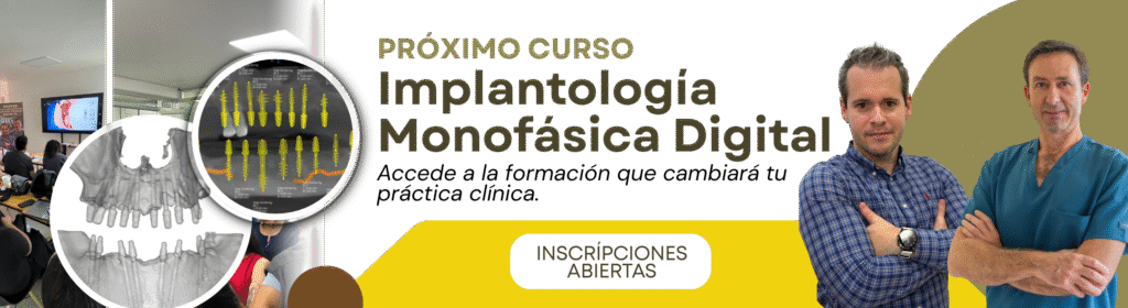 Curso implantes dentales monofasicos cdmx