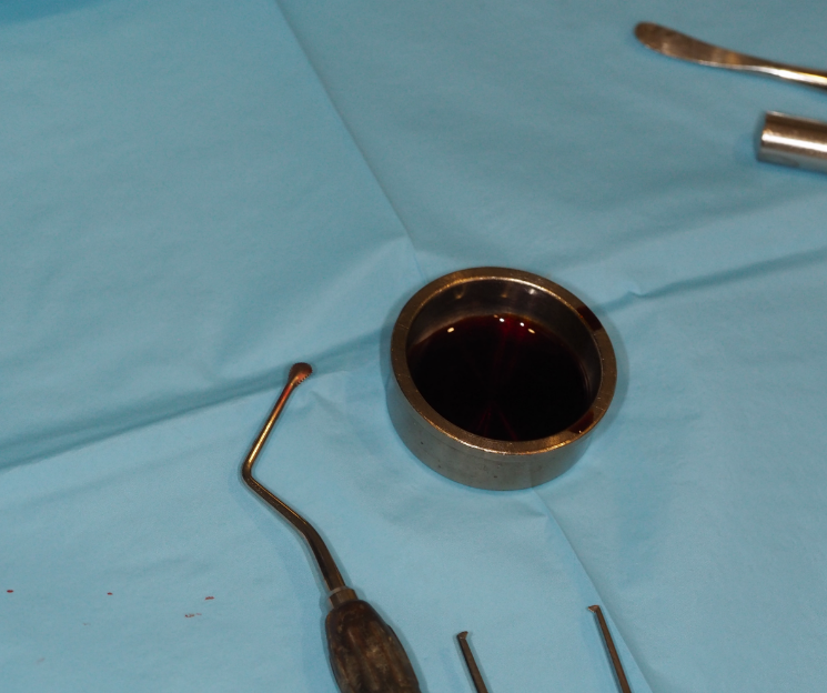 curso implantes el paciente no pasó ni un día sin diente