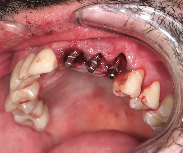 mejores cursos de odontología avanzada méxico