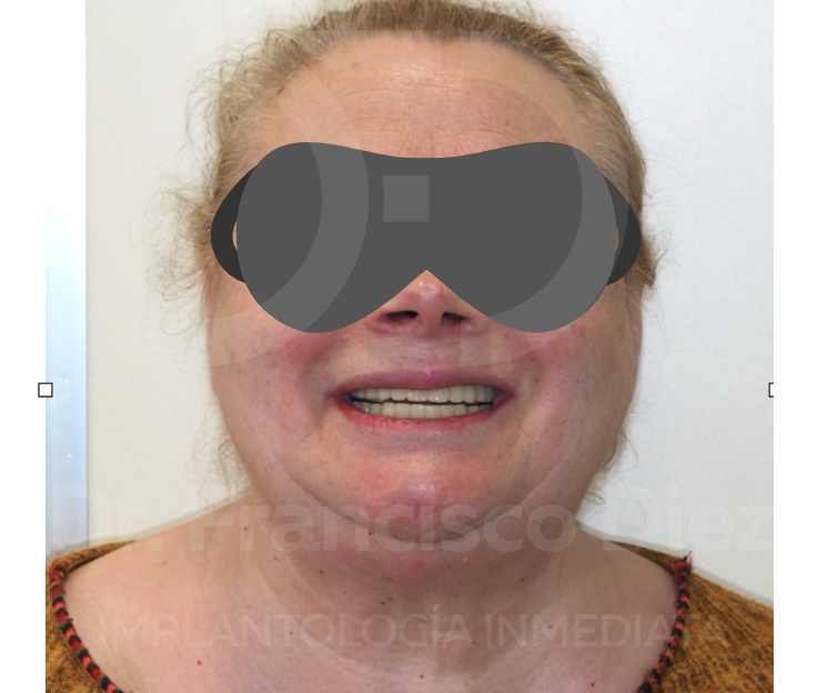 mal diagnóstico dental capacitación méxico