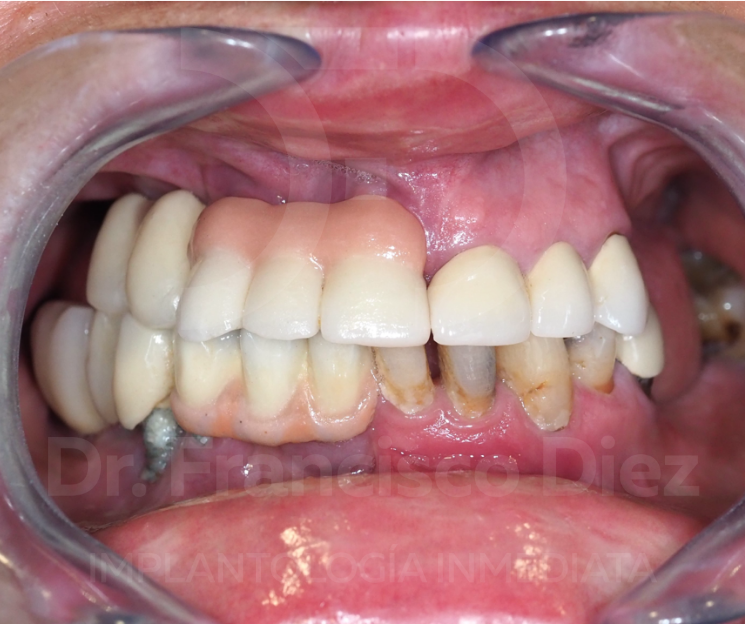 rehabilitación oral en ancianos curso méxico